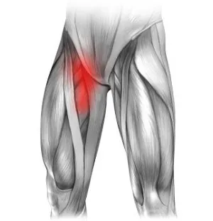 Naderwanie mięśni i ból w prawej pachwinie promieniujący na nogę