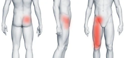 Staw biodrowy i ból w prawej pachwinie promieniujący na nogę